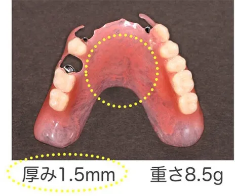 付け心地がいい バネの見えない入れ歯