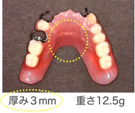 付け心地がいい 従来の部分入れ歯